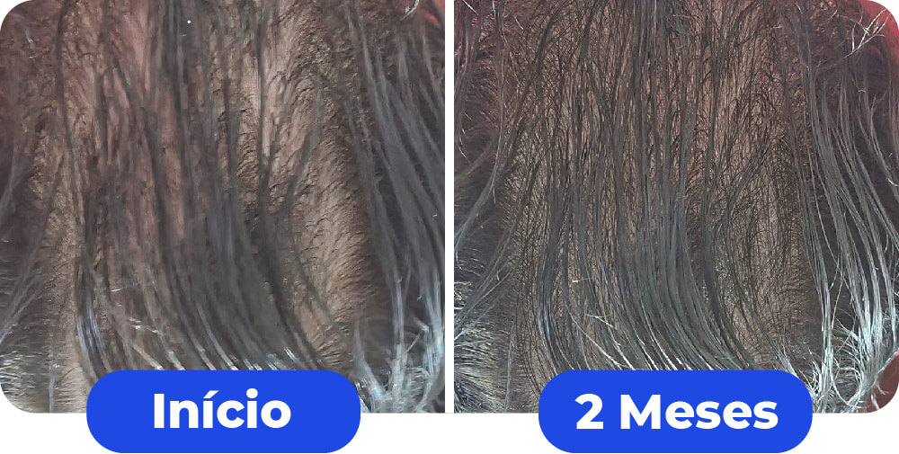 1comparativo-maxxhair-01